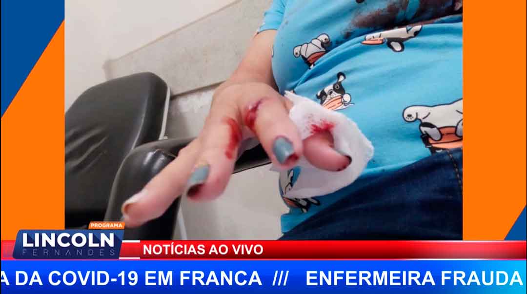 Dona De Cão Atacado Por Pittbull Em Jaboticabal Pede Ajuda