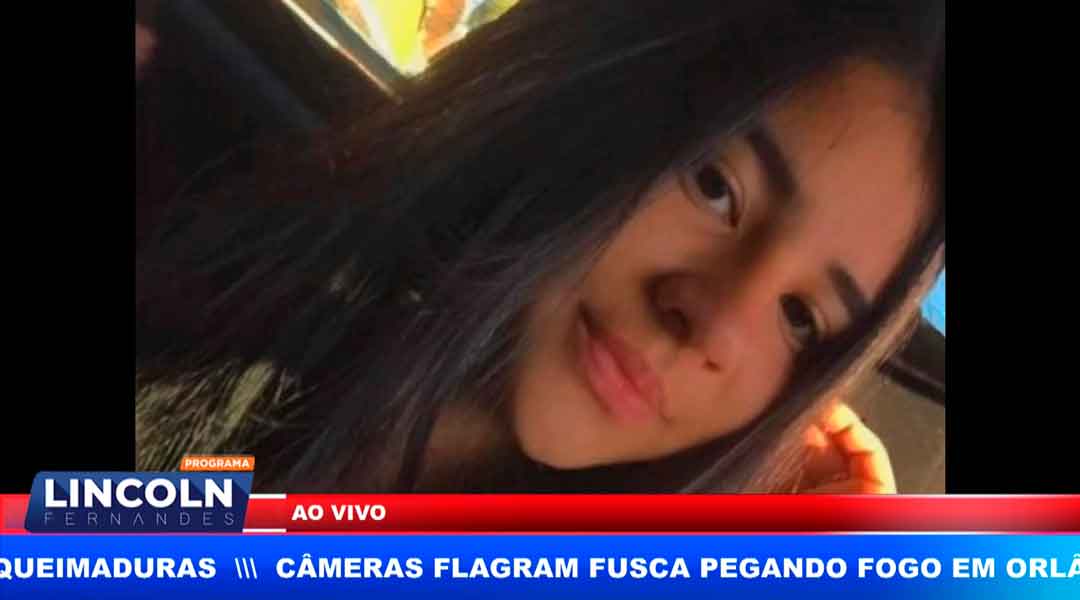 Jovem Que Sofreu Queimaduras Graves Não Resisitu E Faleceu