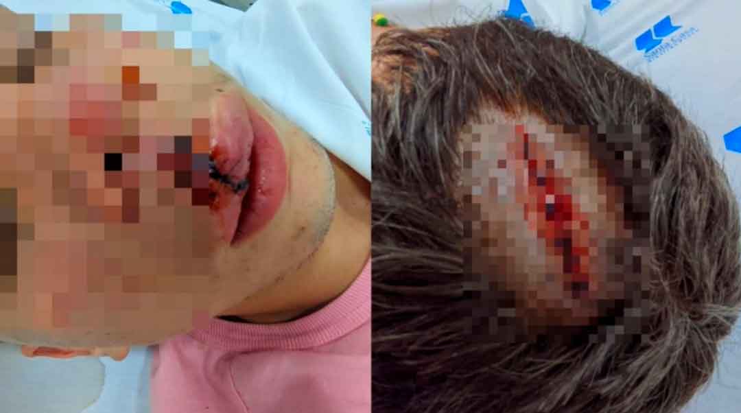 Adolescente É Espancado No Parque Maurílio Biagi, Em Ribeirão Preto