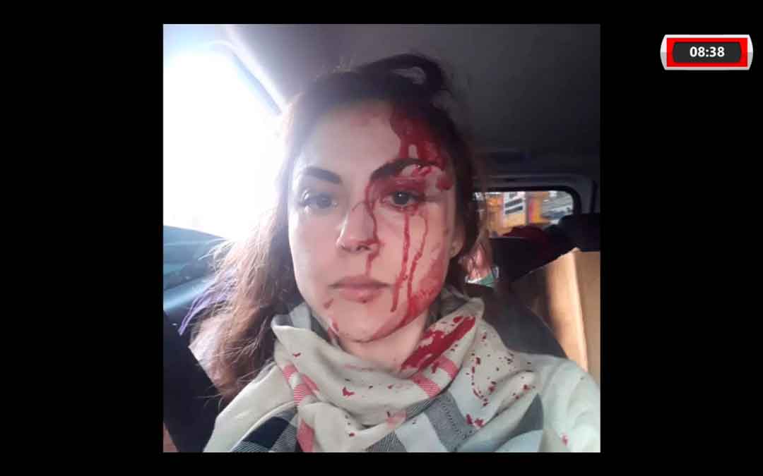 Procudora É Brutalmente Agredida Por Colega De Trabalho Em Sp, Após Abertura De Processo Disciplina