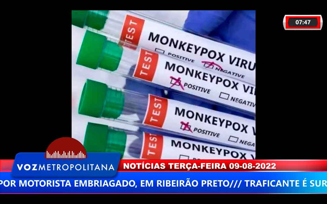 Sobe Para 13, O Número De Casos De Varíola Dos Macacos Em Ribeirão Preto