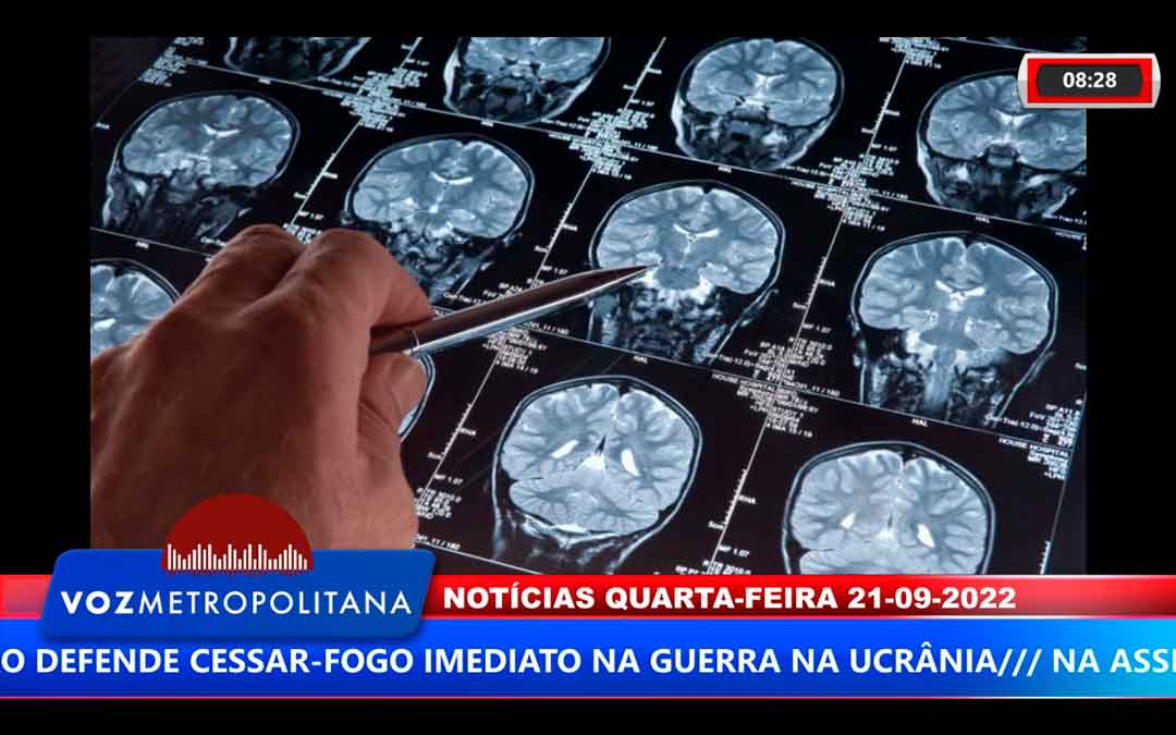 Alzheimer Pode Ser Uma Doença Autoimune Do Cérebro, Diz Pesquisador