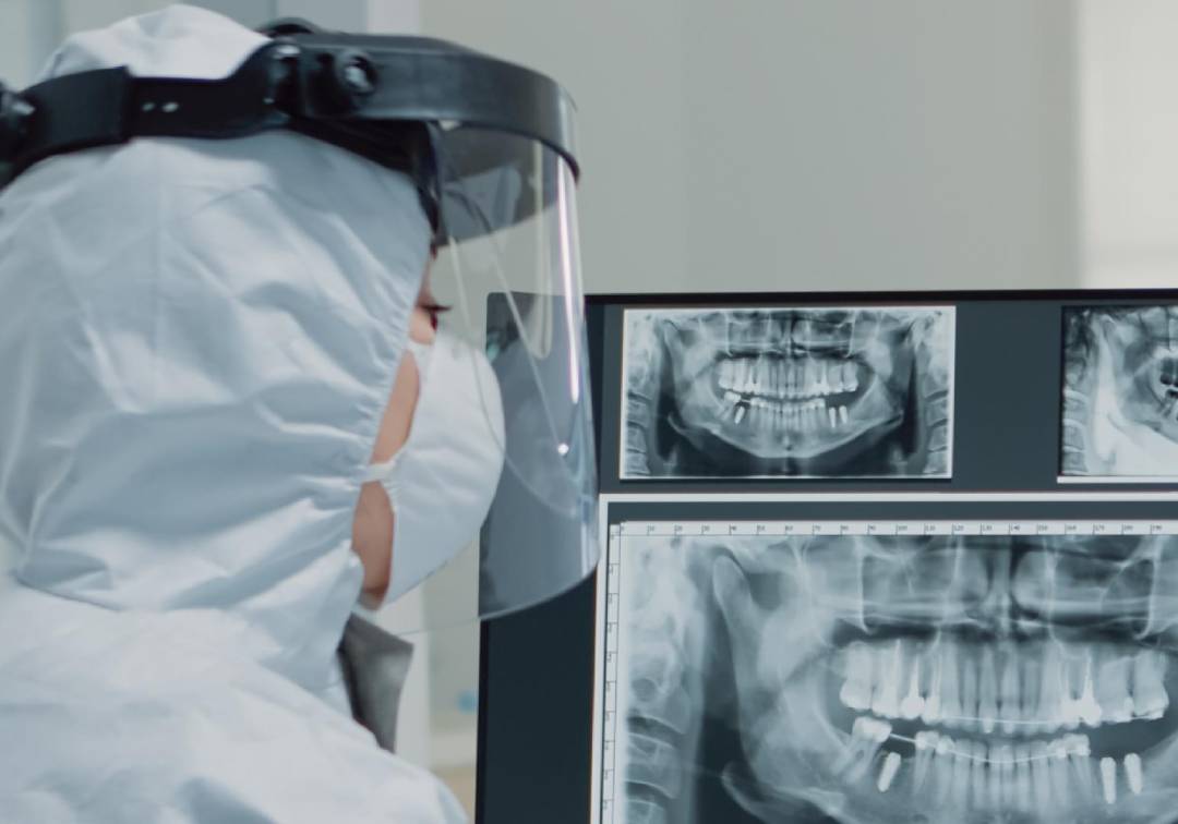 Centro de Especialidades Odontológicas adquire sensor para radiografia digital