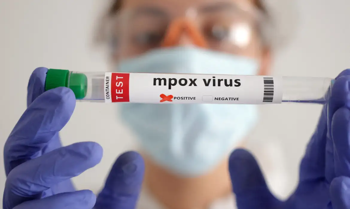 OMS estima custo de US$ 135 milhões em 6 meses para conter mpox