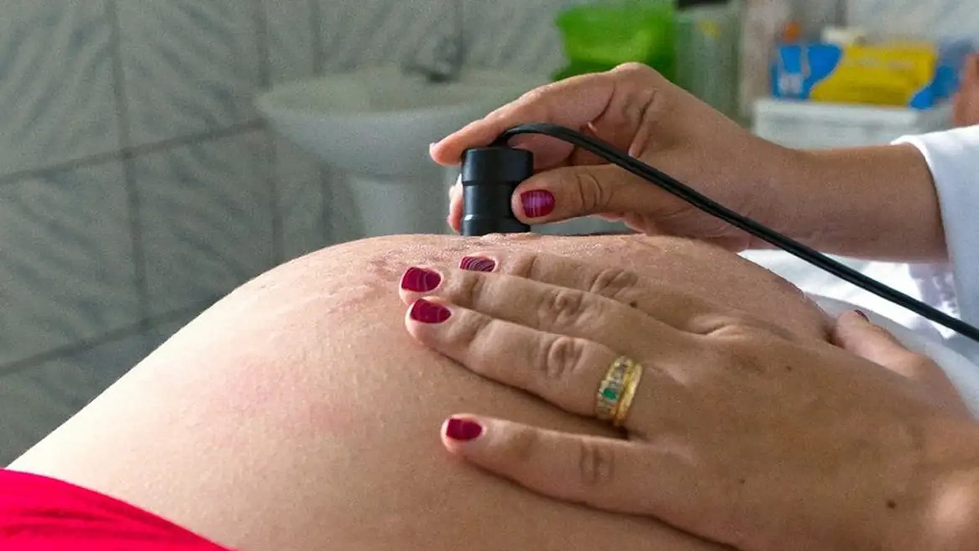 Saúde recomenda cálcio para todas as gestantes para prevenir eclâmpsia