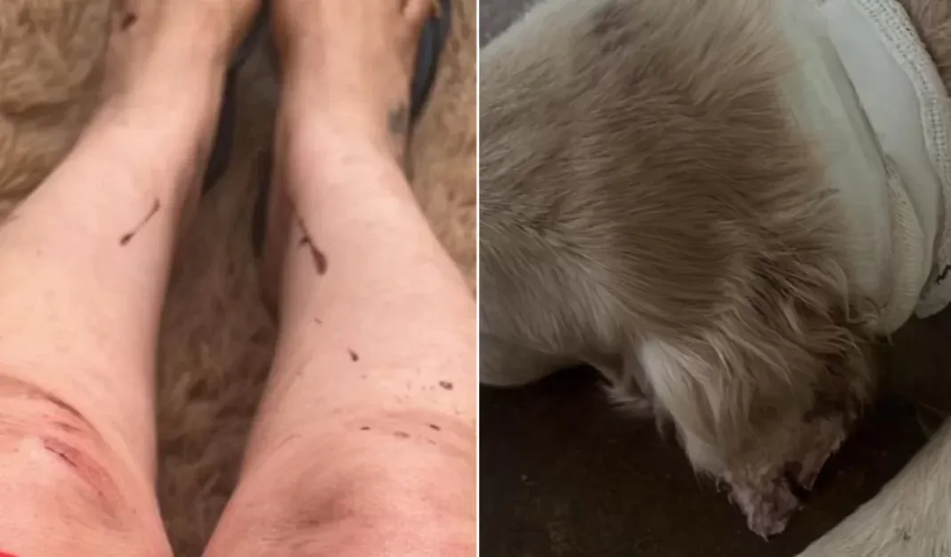 Mulher e sua cachorra ficam feridas após ataque de pit bull em praça no Alto da Boa Vista