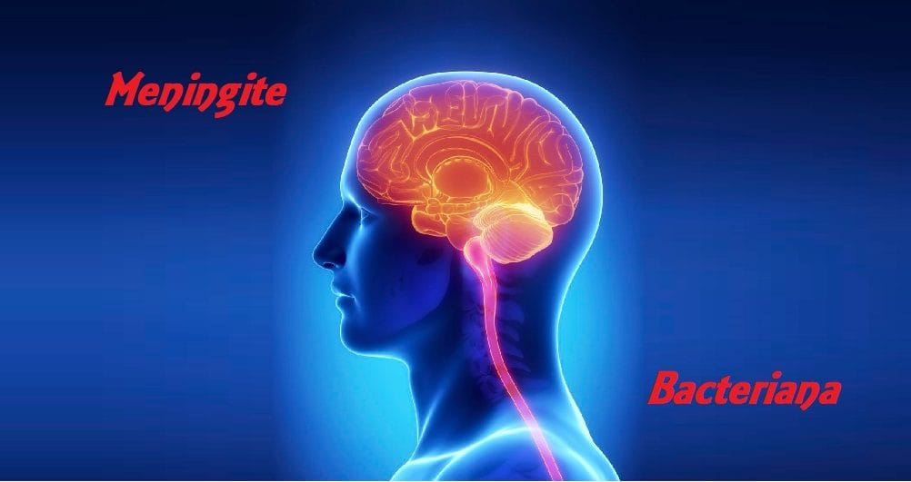 Jaboticabal confirma caso de meningite bacteriana