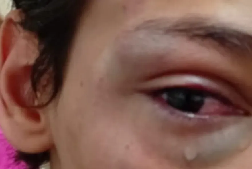 Adolescente sofre nova agressão em escola estadual de São Joaquim da Barra; mãe registra boletim