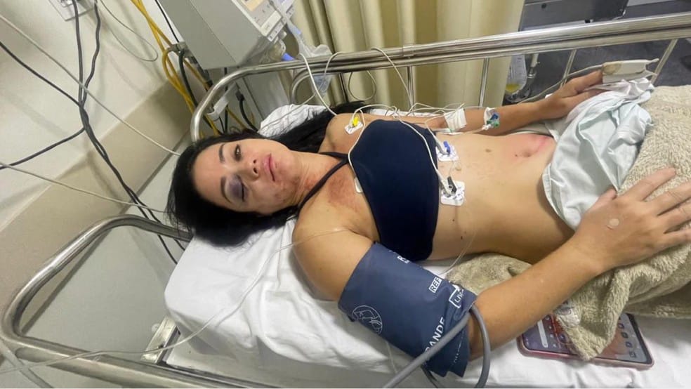 Mãe anuncia ação contra prefeitura após motociclista ferida em buraco no Centro de Pontal