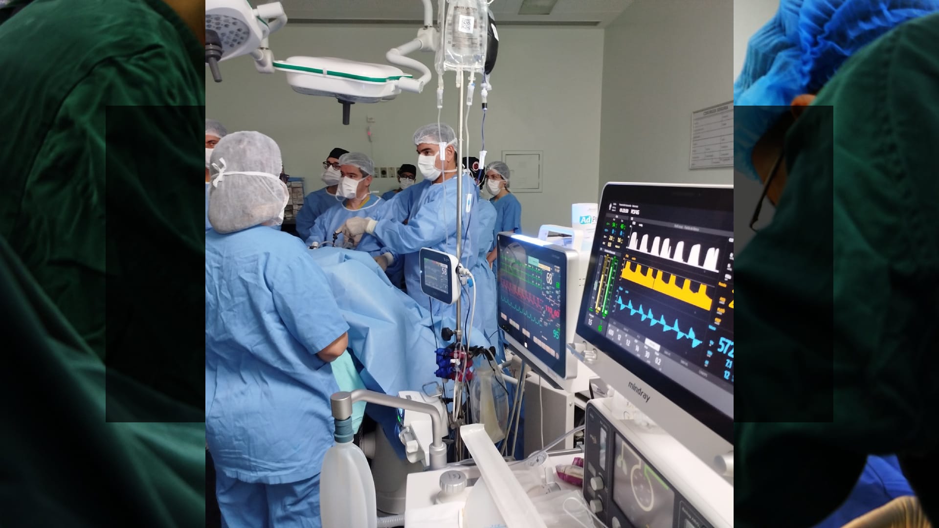 HC de Ribeirão Preto realiza primeira cirurgia de bipartição intestinal e avança rumo a transplante inédito