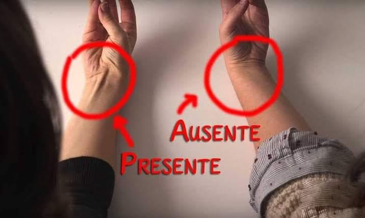 USP-Ribeirão abre inscrições para estudo sobre ausência do músculo palmar longo e impacto na função do braço