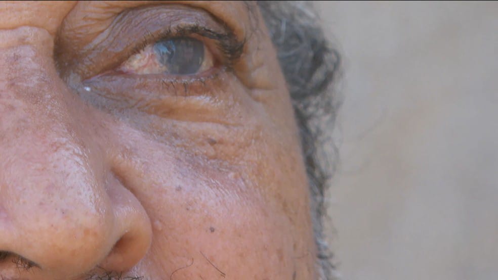 Justiça determina pensão, indenização e acompanhamento integral a vítimas de mutirão de catarata em Taquaritinga