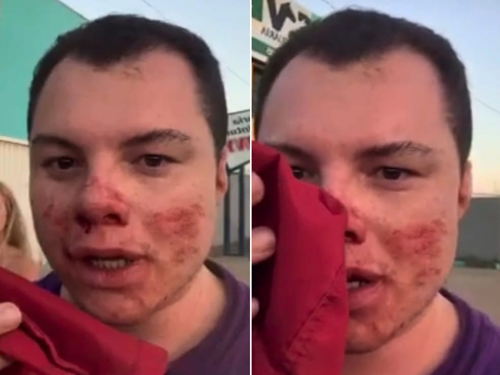 Influenciador é agredido durante 'Economíadas' em São Carlos e segue em estado grave na UTI