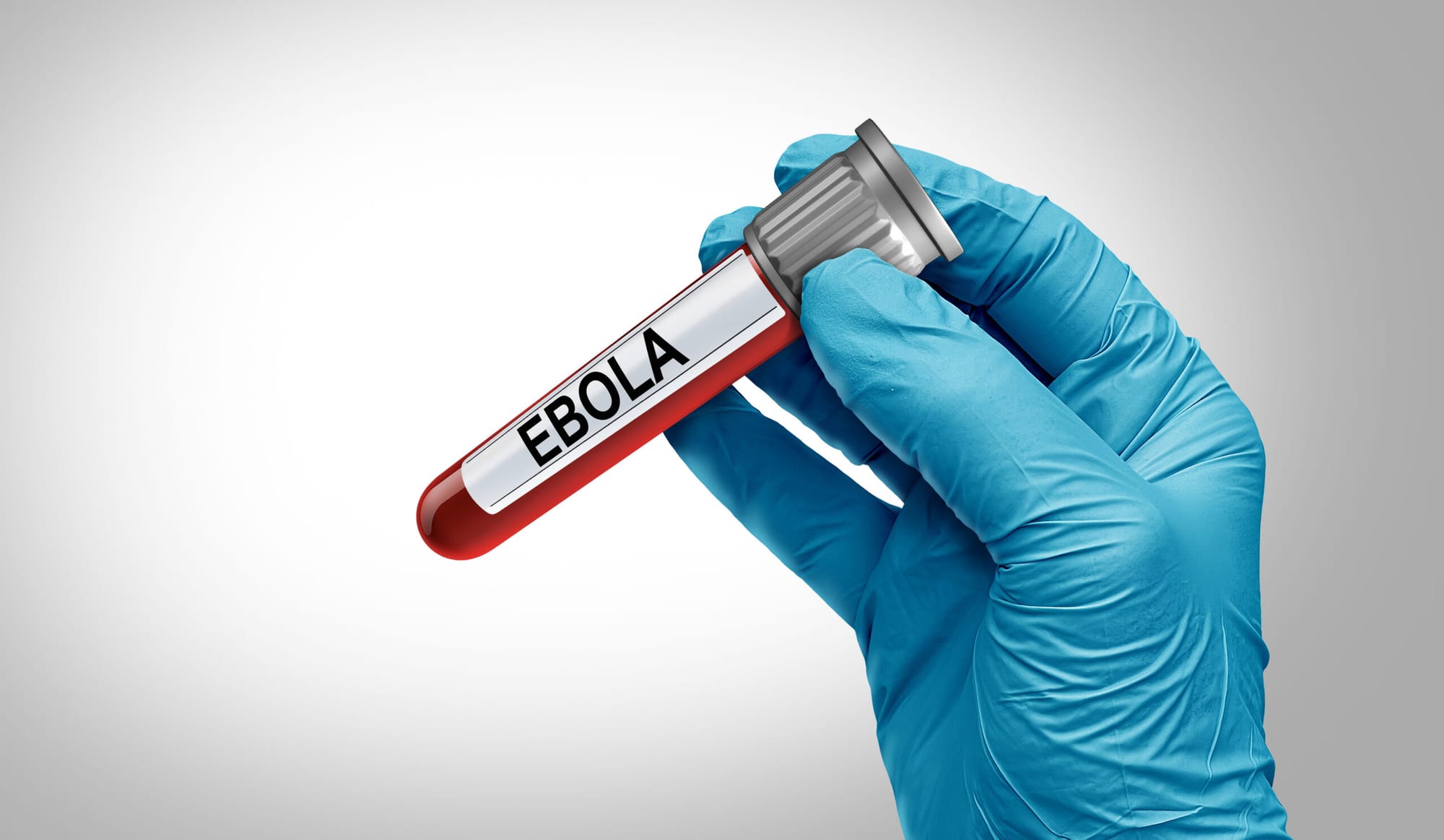 Exame descarta caso de ebola em paciente internado em hospital de São Paulo