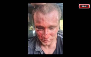 Polícia Prende Homem Que Incendiou E Matou A Ex-Namorada Em Araraquara