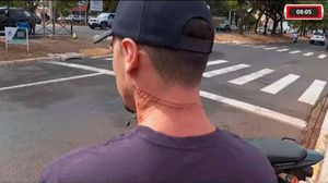 Eletricista Fica Com O Pescoço E O Rosto Feridos Após Ser Atingido Por Fios Soltos, Em Ribeirão Preto