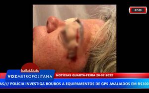 Mulher De Franca Acusa Dermatologista Por Erro Médico Em Cirurgia Para Retirar Excesso De Pele De Pálpebras