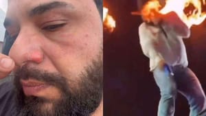 Cantor sertanejo Léo sofre queimaduras leves após incidente com máquina de fogo em show em Pontal