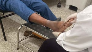 Saúde realiza exame para prevenção de complicações em diabéticos