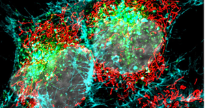 USP de Ribeirão Preto desenvolve plataforma com IA para avaliar agressividade do câncer