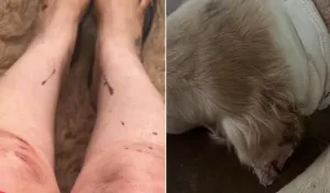 Mulher e sua cachorra ficam feridas após ataque de pit bull em praça no Alto da Boa Vista