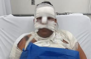 Ex-companheiro é detido em Sertãozinho após agredir mulher com chá quente