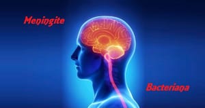 Jaboticabal confirma caso de meningite bacteriana