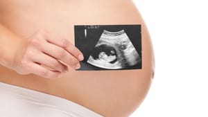 UBS do Jardim Santa Rosa lança curso gratuito para gestantes com início em 19 de agosto