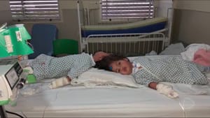 Gêmeas siamesas Heloísa e Helena recebem alta após primeira cirurgia em Ribeirão Preto