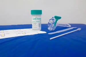 Ribeirão Preto inicia rastreamento molecular do HPV pelo SUS e amplia detecção precoce do câncer do colo do útero