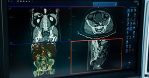 Radiografia com suporte de IA nas UPAs de Ribeirão Preto: avaliação crítica para implantação segura e eficaz
