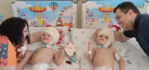Segunda etapa de separação de gêmeas craniopágicas em Ribeirão Preto é concluída; próximos procedimentos ficam para 2026